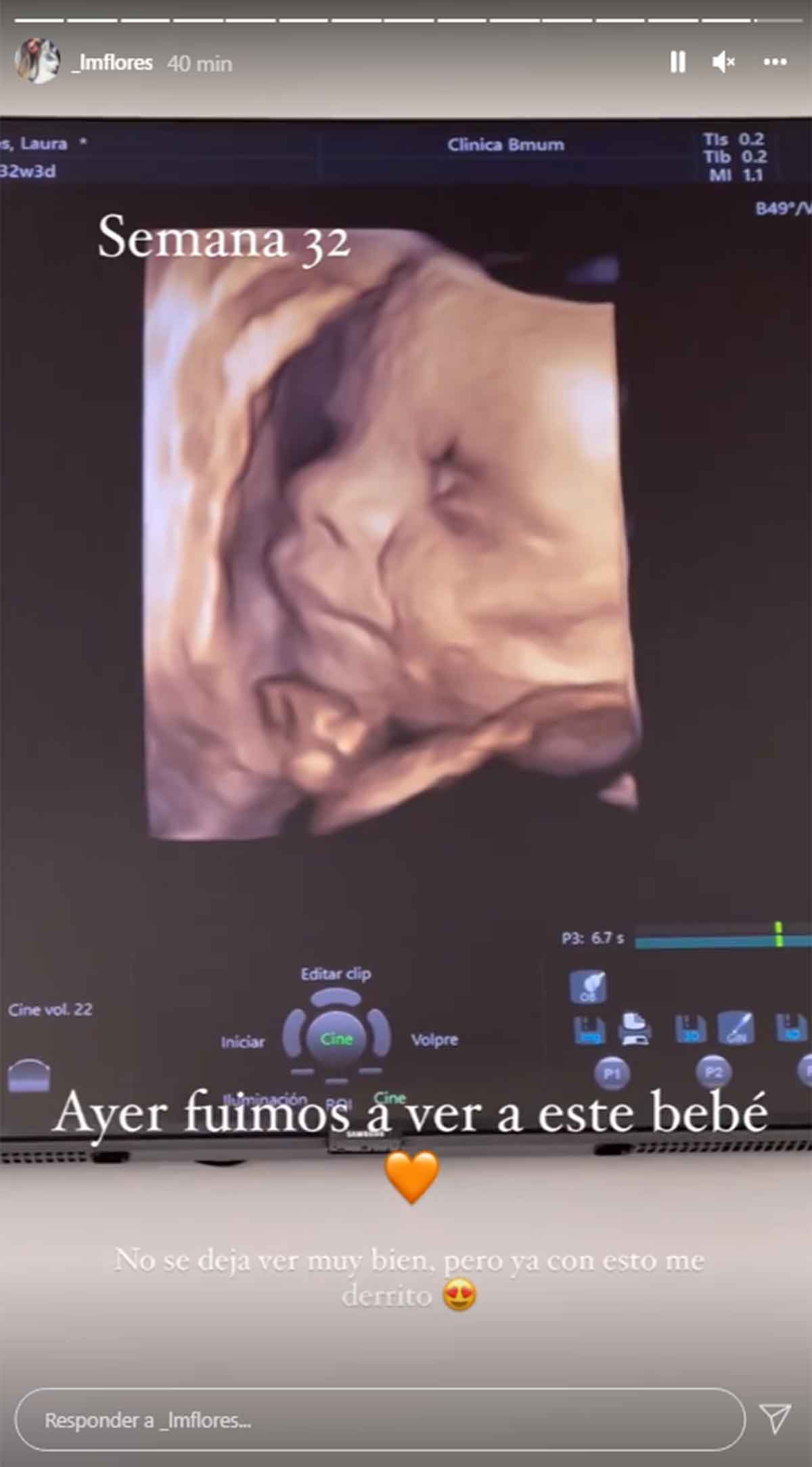 Laura Matamoros bebé