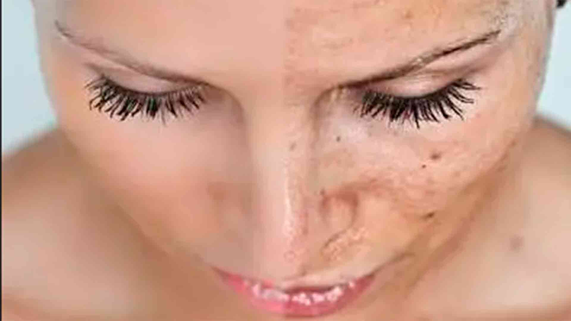 Imagen de Los mejores peeling para renovar tu piel  